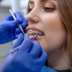 Orthodontic Solutions in turkey istanbul