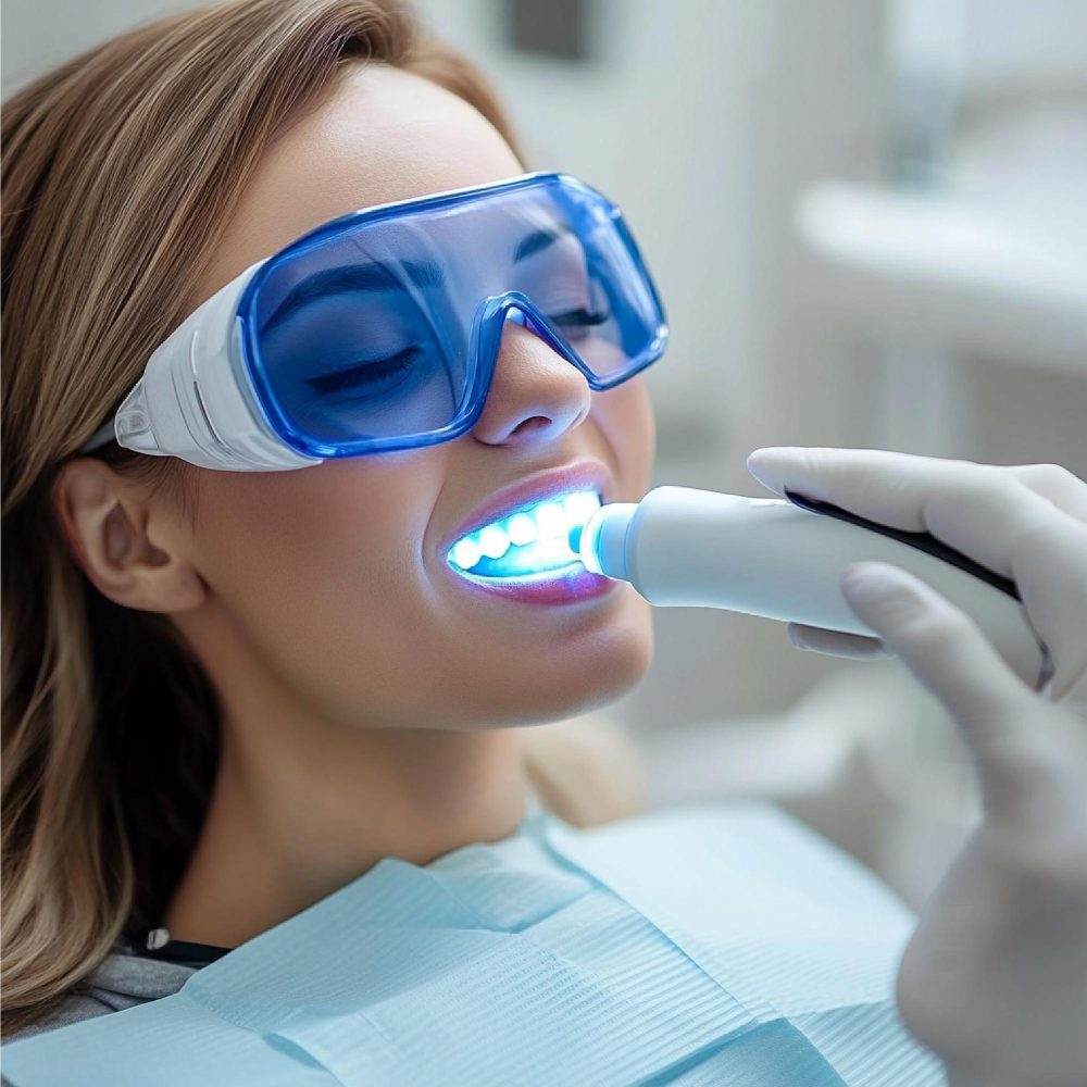 Professional Teeth Whitening